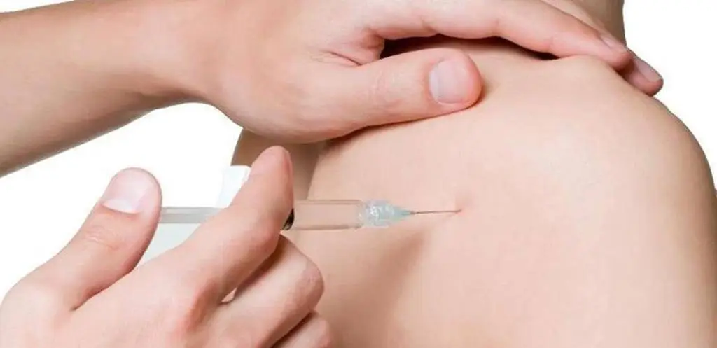 Ilustração de tratamento com infiltrações